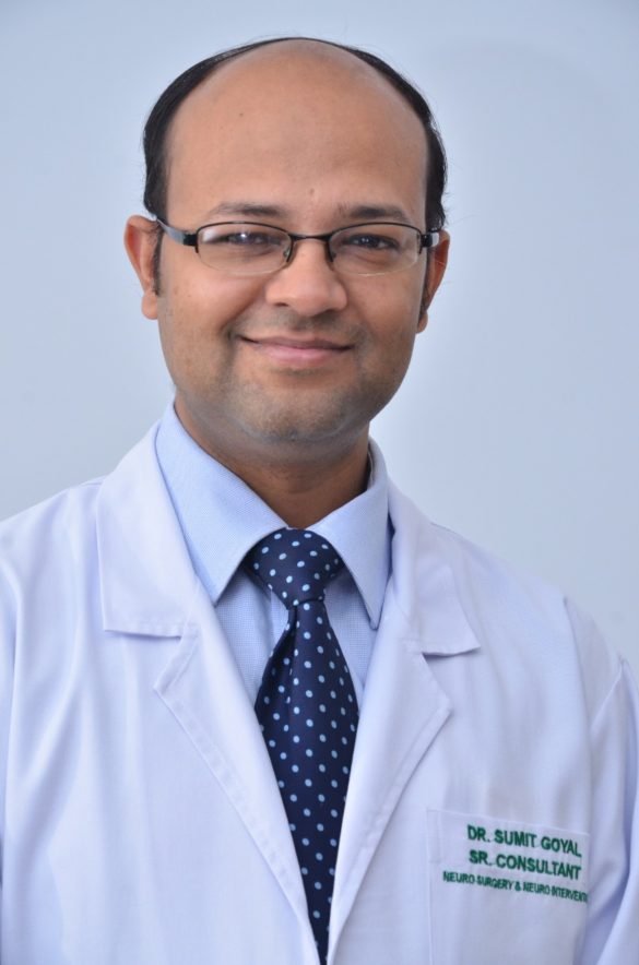 dr-sumit-goyal-neurosurgeon-in-delhi